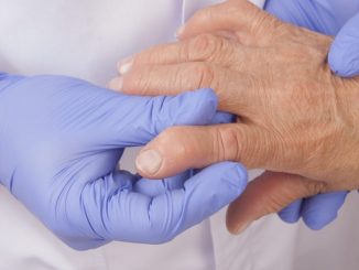 Los pacientes de edad avanzada con artritis reumatoide pueden subestimar la actividad de la enfermedad