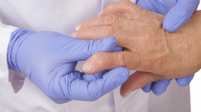 Los pacientes de edad avanzada con artritis reumatoide pueden subestimar la actividad de la enfermedad
